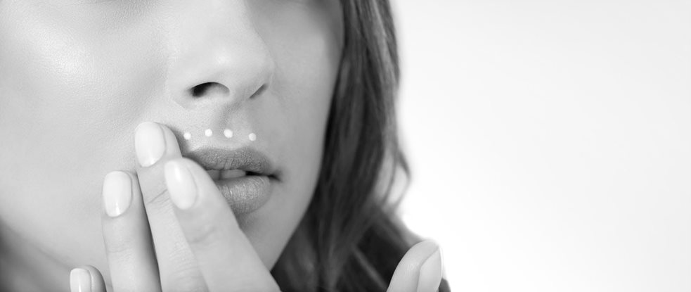 Cara femenina con melasma