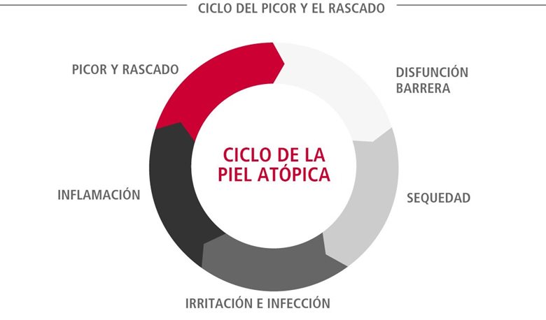 Ciclo de la piel atópica (también conocido como ciclo del picor y el rascado)